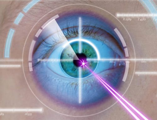 عيوب الليزر السطحي